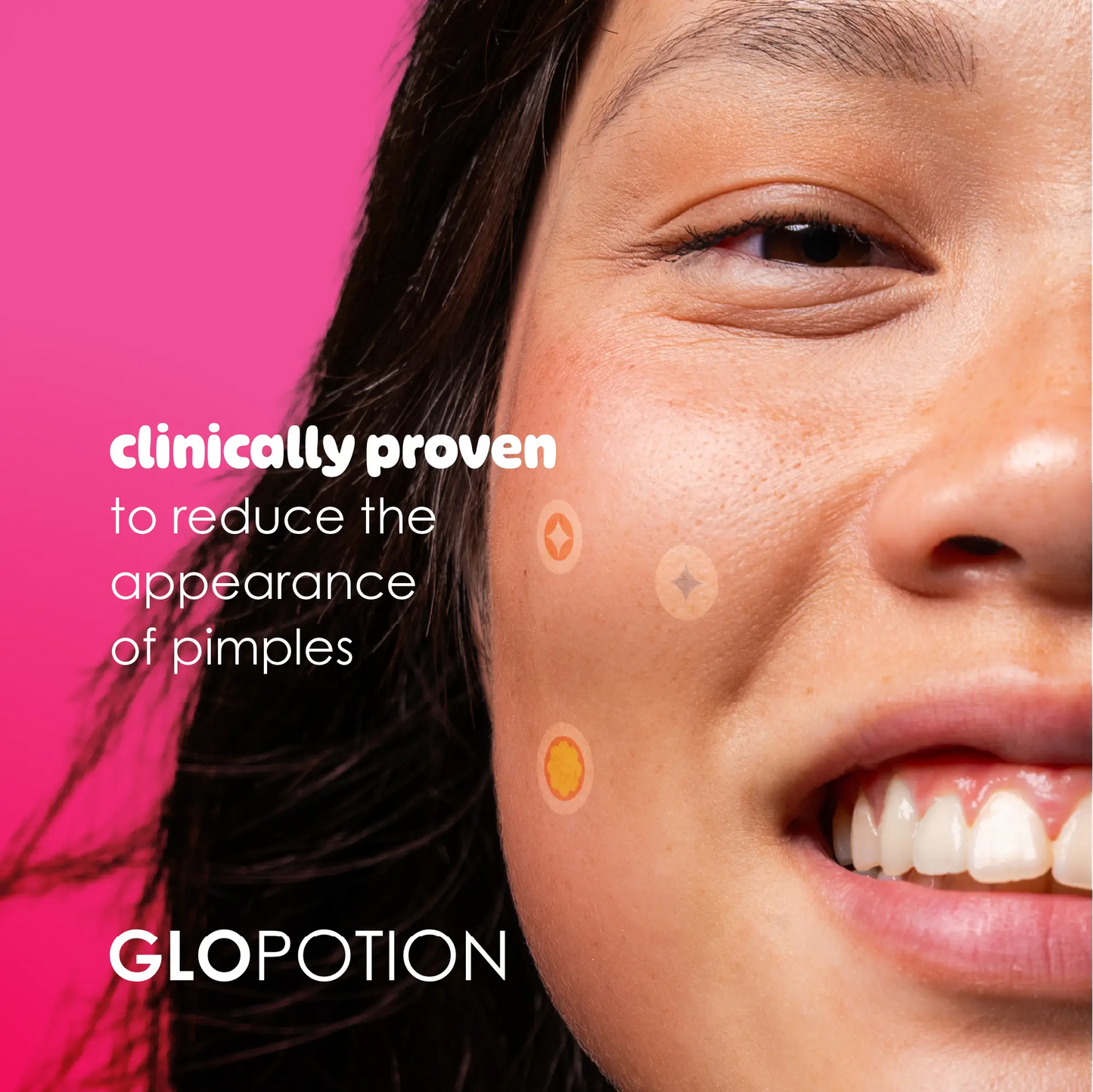 salicylic acid pimple patches (36 patches)